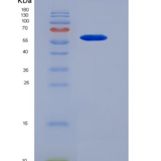 小鼠轴突生长诱向因子1(Ntn1)重组蛋白