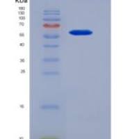 小鼠轴突生长诱向因子1(Ntn1)重组蛋白