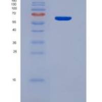 小鼠微管关联蛋白2(MAP2)重组蛋白