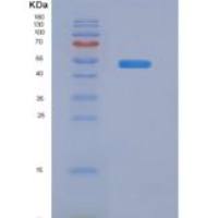人组蛋白脱乙酰基酶3(HDAC3)重组蛋白