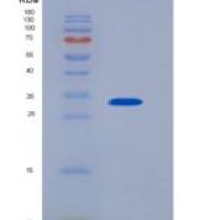 人Carbonic Anhydrase XII (CA12)重组蛋白