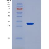 小鼠Slit同源物3(Slit3)重组蛋白