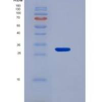 小鼠Slit同源物3(Slit3)重组蛋白