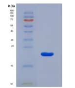 人肽聚糖识别蛋白1(PGLYRP1)重组蛋白