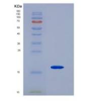 小鼠糖皮质激素诱导肿瘤坏死因子受体(GITR)重组蛋白