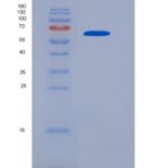 大鼠白介素18受体1(IL18R1)重组蛋白