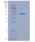 人转铁蛋白受体2(TFR2)重组蛋白