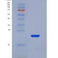 人钠/葡萄糖协同转运蛋白1(SGLT1)重组蛋白