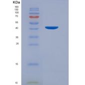 大鼠血管内皮钙黏蛋白(CDH5)重组蛋白