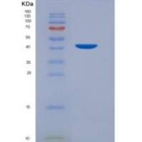 大鼠血管内皮钙黏蛋白(CDH5)重组蛋白