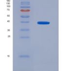 人Toll样受体4(TLR4)重组蛋白