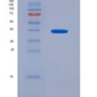 人Toll样受体4(TLR4)重组蛋白