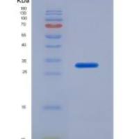 人CD42b分子(CD42b)重组蛋白