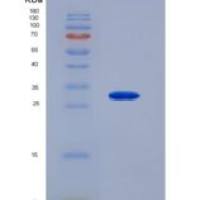 人脯氨酸脱氢酶(PRODH)重组蛋白