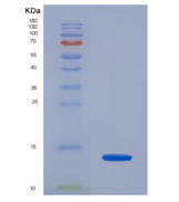 人抗缪勒管激素(AMH)重组蛋白