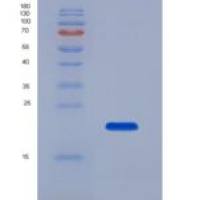 人钠/钾离子转运ATP酶α1肽(ATP1a1)重组蛋白