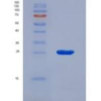 大鼠细胞色素P450家族成员11A1(CYP11A1)重组蛋白