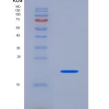 人蛋白S(PROS)重组蛋白