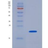 大鼠B-细胞激活因子受体(BAFFR)重组蛋白