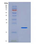 人蛋白S(PROS)重组蛋白