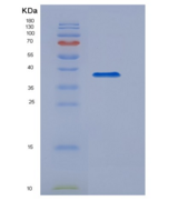 人TANK结合激酶1(TBK1)重组蛋白