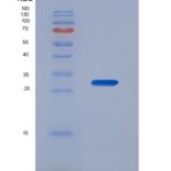 人半胱氨酸丰富分泌蛋白3(CRISP3)重组蛋白