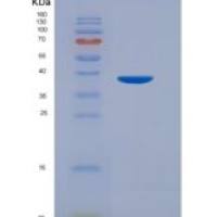 人钙调磷酸酶(CaN)重组蛋白