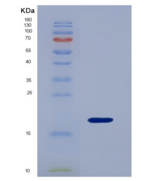 大鼠D类清道夫受体1(SCARD1)重组蛋白