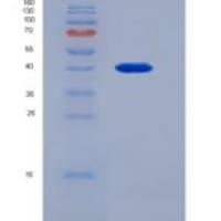 人钙联接蛋白(CLGN)重组蛋白