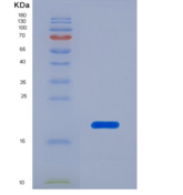 人淀粉样β肽1-40重组蛋白 (Ab1-40)