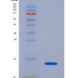人抗缪勒管激素(AMH)重组蛋白