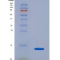 人抗缪勒管激素(AMH)重组蛋白