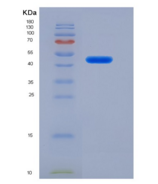 小鼠α1-抗胰糜蛋白酶(a1ACT)重组蛋白