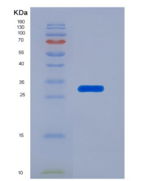 人硒蛋白P1(SEPP1)重组蛋白