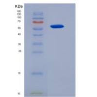 人单氨氧化酶B(MAOB)重组蛋白