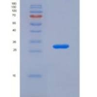 小鼠胰岛素样生长因子结合蛋白5(IGFBP5)重组蛋白