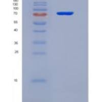 人90kDa热休克蛋白αA1(HSP90aA1)重组蛋白
