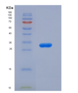 人5-脂氧合酶(5-LO)重组蛋白