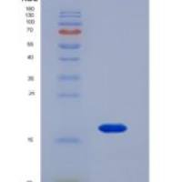 人小脯氨酸丰富蛋白1A(SPRR1A)重组蛋白