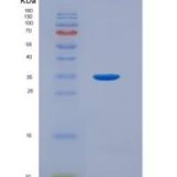 大鼠血管内皮生长因子受体2(VEGFR2)重组蛋白