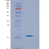 小鼠类胰蛋白酶(TPS)重组蛋白