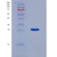 小鼠基质金属蛋白酶2(MMP2)重组蛋白