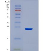 小鼠α1-酸性糖蛋白(a1AGP)重组蛋白