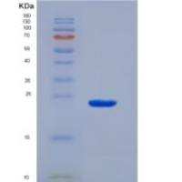 小鼠α1-酸性糖蛋白(a1AGP)重组蛋白