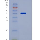 人免疫球蛋白A1(IgA1)重组蛋白