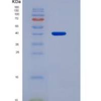 人免疫球蛋白A1(IgA1)重组蛋白
