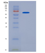 大鼠白介素18受体1(IL18R1)重组蛋白