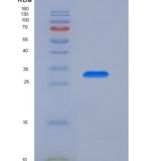 人胰岛素受体底物1(IRS1)重组蛋白