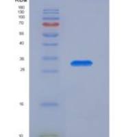 人胰岛素受体底物1(IRS1)重组蛋白