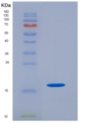 大鼠衰变加速因子(CD55)重组蛋白